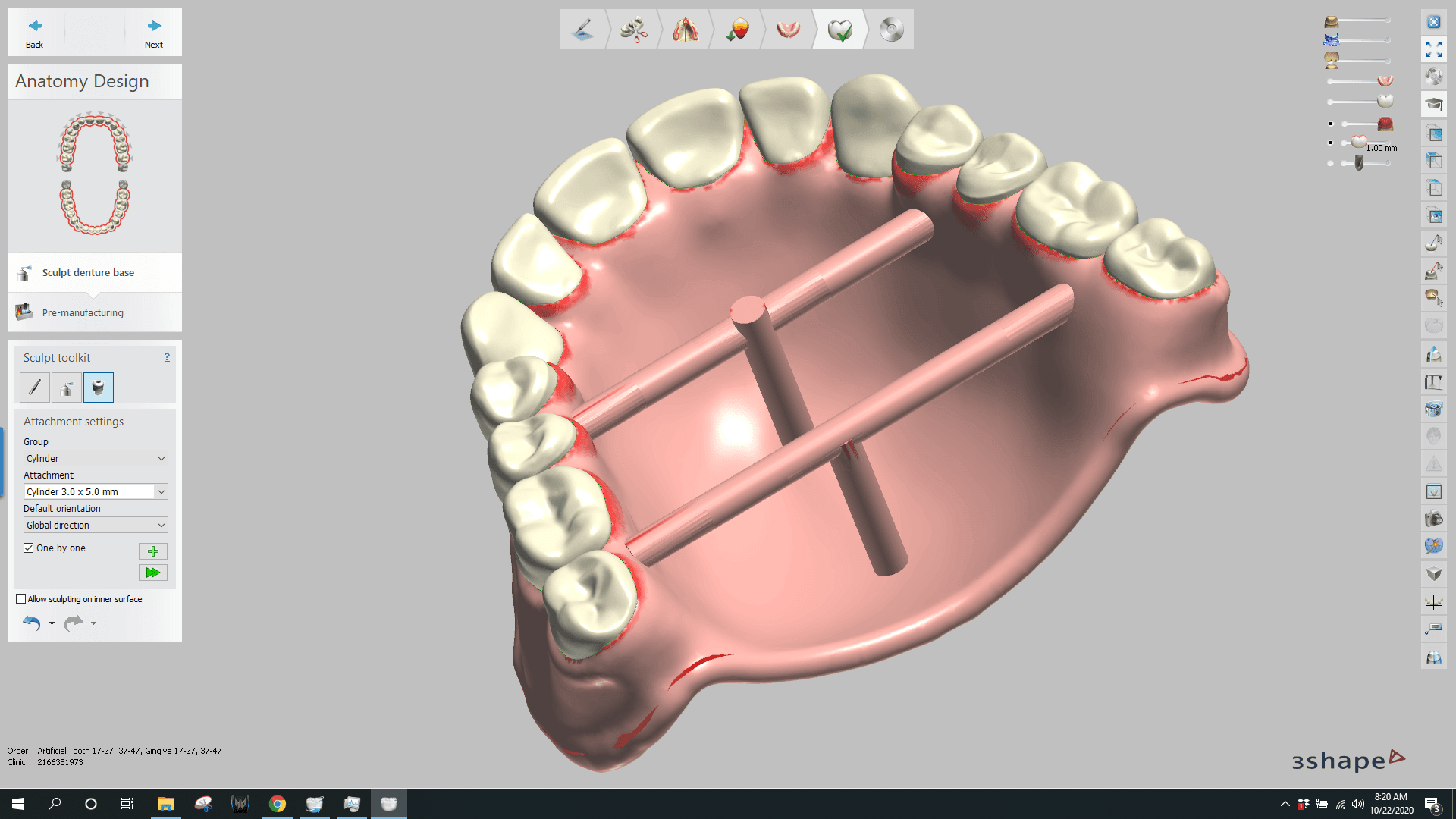 Designing dentures